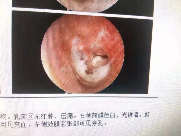 余福銀最新,余福銀最新論述，多維度視角下的觀點(diǎn)分析