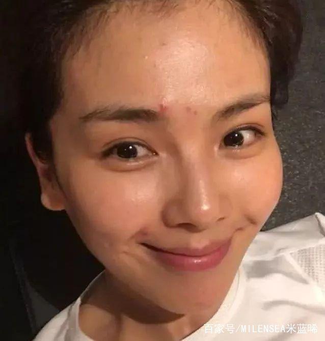 最新痘印歌曲掀起音樂(lè)熱潮！